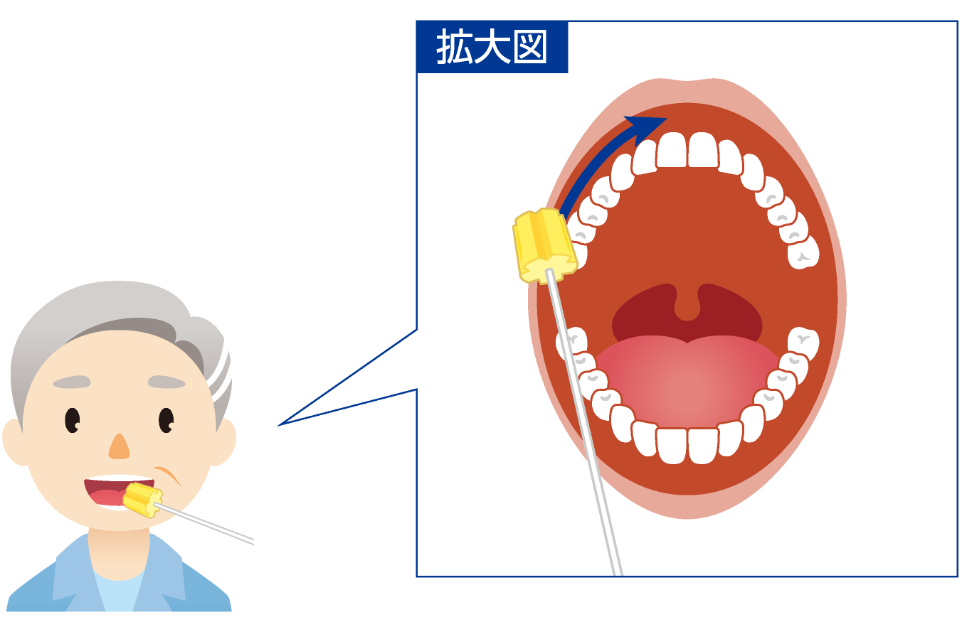 口腔ケア用スポンジブラシの使い方１