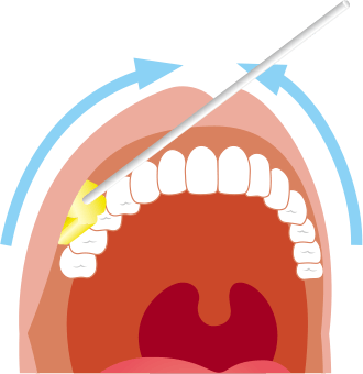 上あごの歯の外側（歯と口唇の間）