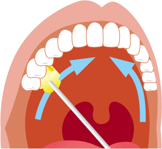上あごの歯の内側
