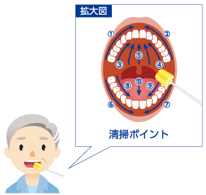 口腔内清掃