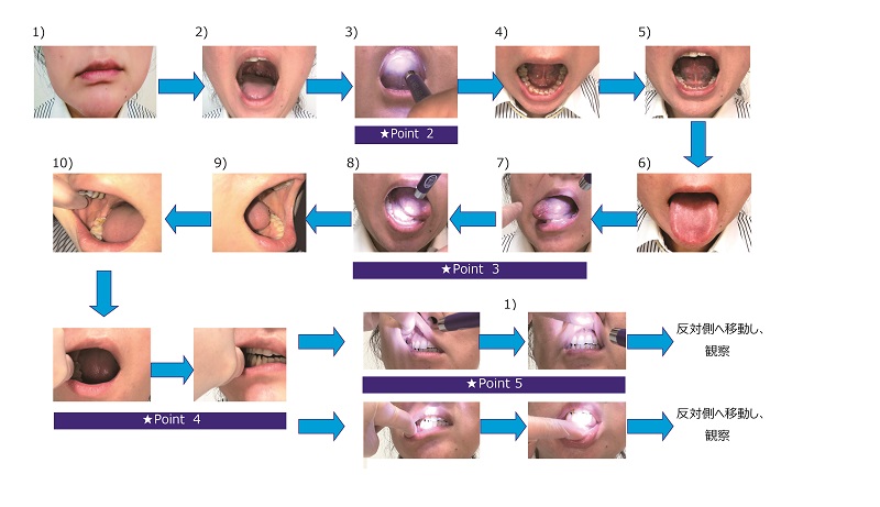 患者さんの口腔内を観察する場合　～日々の検温や口腔ケア介助の前に～